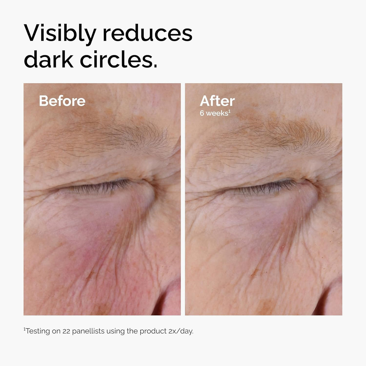 The Ordinary Caffeine Solution 5% + EGCG, Depuffing Eye Serum for Dark Circles and Tired Eyes