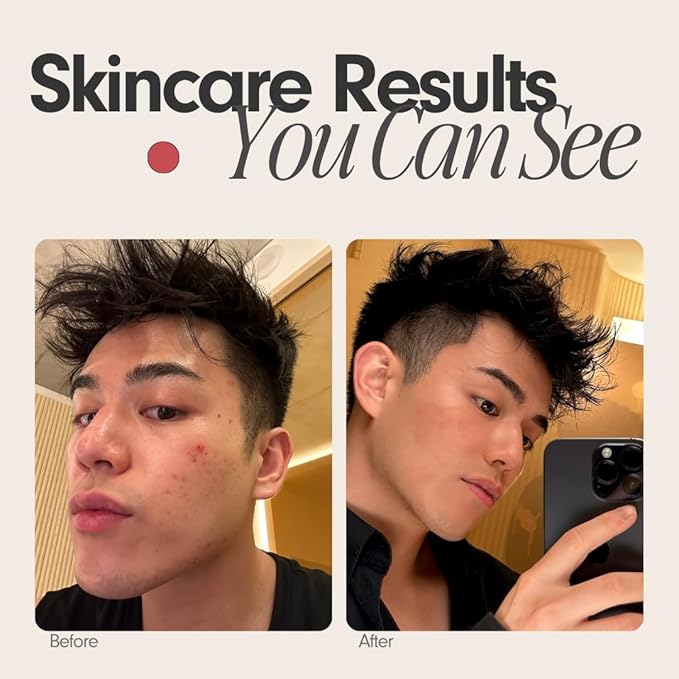 Sxnse Palm Silicone Face Scrubber – Compact Electric Facial Cleansing Brush for Acne, Pores & Makeup – Waterproof Face Exfoliator with 3 Speeds – Rechargeable Skincare Tool for Sensitive Skin (Cherry)