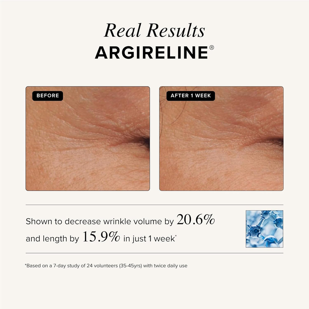 Asterwood Triple Repair Matrixyl 3000 + Argireline + Hyaluronic Acid + Vitamin C Serum for Face - Anti-Aging, Collagen Boosting, Hydrating - Fragrance-Free - 1 Fl Oz