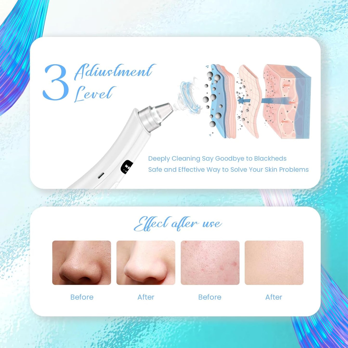 2025 Blackhead Remover Pore Vacuum, Blackhead Extractor-5 Suction Power 3 Adjustable Suction,USB Rechargeable Facial Pore Cleaner Kit Electric Acne Extractor Tool for Women & Men (White)