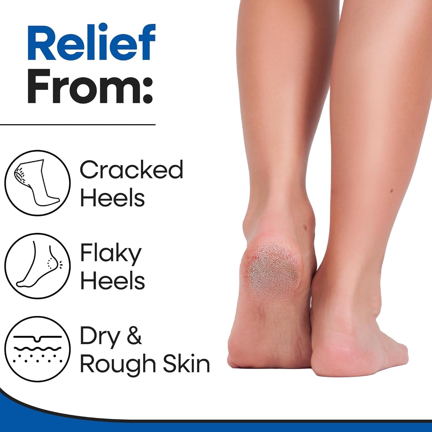 Moisturizing Socks for Men | Cracked Heel Treatment with Aloe Vera | Moisturizer Foot Callus Remover | Aloe Socks for Cracked Heels & Dry Cracked Feet | Lotion Infused Gel Heel Socks (XL - 3 Pairs)