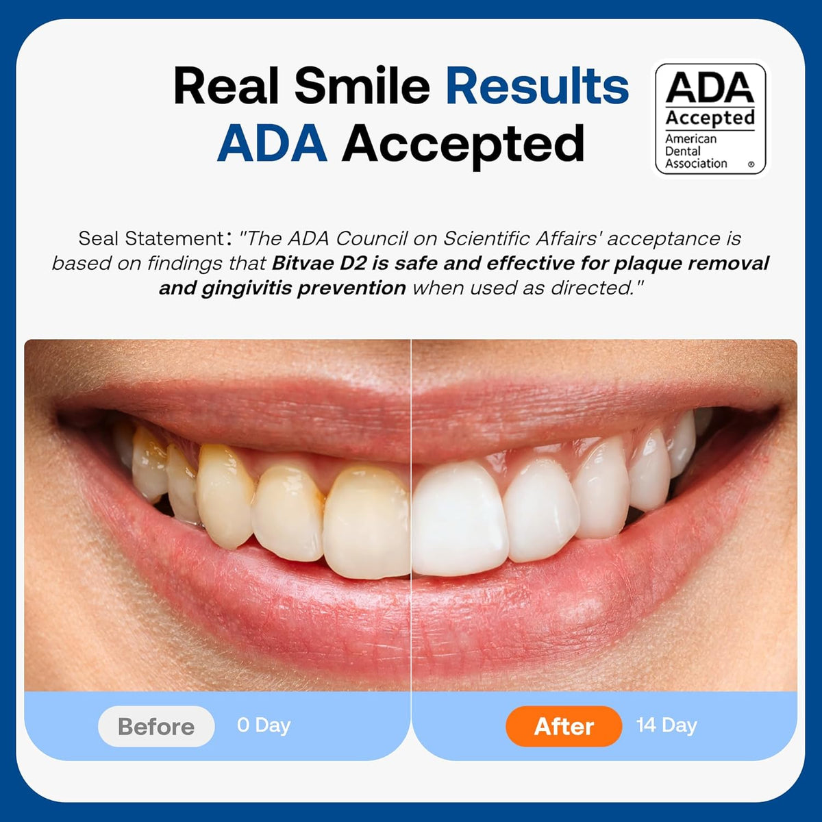 Bitvae ADA Accepted Electric Toothbrush, Travel Toothbrush Rechargeable for Adults and Kids, 60-Day Battery, 5 Modes, 8 Heads, Portable Travel Case & Holder, Shadow Black